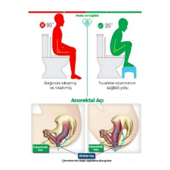 Klozet Çömelme Ayak Taburesi, Wc Basamak, Wc Tuvalet Taburesi, Klozet Ayaklığı